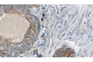 ABIN6275626 at 1/100 staining Human prostate tissue by IHC-P. (CCT6A Antikörper  (Internal Region))