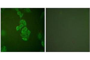 Immunofluorescence analysis of A549 cells, using NSE antibody (ABIN5976470). (ENO2/NSE Antikörper  (C-Term))