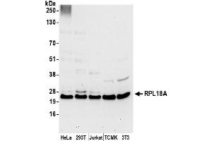 anti-Ribosomal Protein L18a (RPL18A) (AA 75-125) antibody