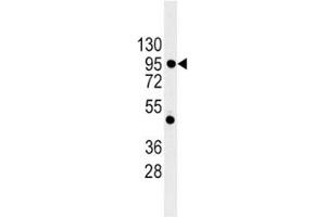 Western Blotting (WB) image for anti-Cadherin 1, Type 1, E-Cadherin (Epithelial) (CDH1) (AA 160-189) antibody (ABIN3030243)