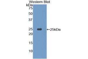 Detection of Recombinant TREM1, Mouse using Polyclonal Antibody to Triggering Receptor Expressed On Myeloid Cells 1 (TREM1) (TREM1 Antikörper  (AA 21-230))