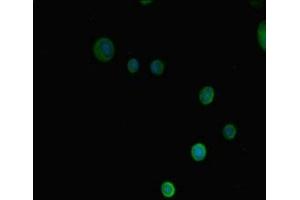 Immunofluorescence (IF) image for anti-Protein Arginine Methyltransferase 3 (PRMT3) (AA 311-529) antibody (ABIN7165067)