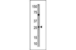 Image no. 1 for anti-BCL2/adenovirus E1B 19kDa Interacting Protein 3 (BNIP3) (BH3 Domain) antibody (ABIN356828) (BNIP3 Antikörper  (BH3 Domain))