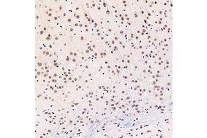 Immunohistochemistry analysis of paraffin-embedded mouse brain using,GTF2F2 (ABIN7074036) at dilution of 1: 3000 (GTF2F2 Antikörper)