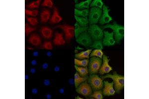 ABIN6258003 and ABIN6273451 staining Hela cells by IF/ICC. (CD5L Antikörper  (C-Term))