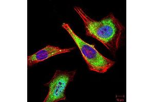 Immunofluorescence analysis of Hela cells using ATG5 mouse mAb (green). (ATG5 Antikörper)