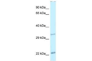 Western Blot showing Pdx1 antibody used at a concentration of 1.