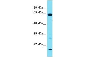 Host:  Rabbit  Target Name:  Tbx18  Sample Type:  Rat Lung lysates  Antibody Dilution:  1. (T-Box 18 Antikörper  (N-Term))