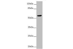 Western blot All lanes: ACVRL1 antibody at 2 μg/mL + MCF-7 whole cell lysate Secondary Goat polyclonal to rabbit IgG at 1/10000 dilution Predicted band size: 57 kDa Observed band size: 57 kDa (ACVRL1 Antikörper  (AA 22-118))
