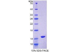 SDS-PAGE (SDS) image for S100 Calcium Binding Protein Z (S100Z) (AA 1-99) protein (His tag) (ABIN4989742)