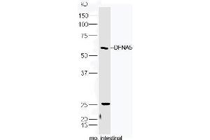 Mouse intestinal lysate probed with Rabbit Anti-DFNA5 Polyclonal Antibody, Unconjugated (ABIN2559452) at 1:300 in 4˚C. (DFNA5 Antikörper  (AA 21-120))