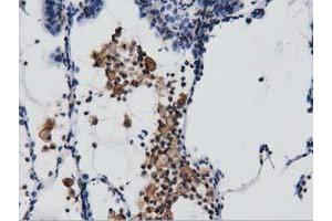 Immunohistochemistry (IHC) image for anti-rho GTPase Activating Protein 25 (ARHGAP25) antibody (ABIN1496706) (ARHGAP25 Antikörper)