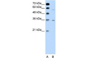 WB Suggested Anti-GPCR5A Antibody Titration:  0. (GPRC5A Antikörper  (C-Term))
