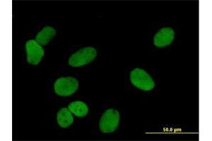 Immunofluorescence of purified MaxPab antibody to PDCD4 on HeLa cell. (PDCD4 Antikörper  (AA 1-469))