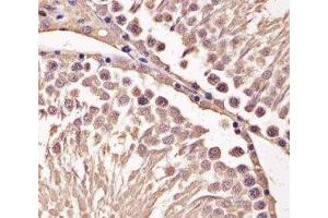 IHC analysis of FFPE mouse testis section using Cyclin B1 antibody; Ab was diluted at 1:25.