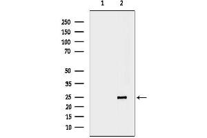 anti-Chromobox Homolog 1 (CBX1) (Internal Region) antibody