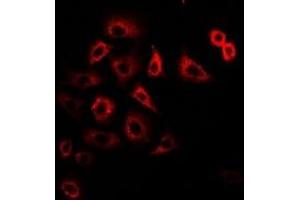 Immunofluorescent analysis of Tim17 staining in U2OS cells. (TIMM17A Antikörper)