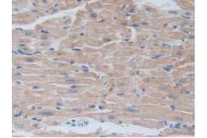 IHC-P analysis of Mouse Heart Tissue, with DAB staining. (BRD8 Antikörper  (AA 797-951))