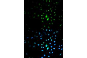 Immunofluorescence analysis of MCF7 cell using PIN1 antibody. (PIN1 Antikörper  (AA 1-163))
