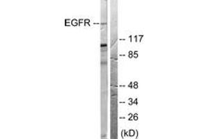Western blot analysis of extracts from 293 cells, treated with EGF 200ng/ml 30', using EGFR (Ab-678) Antibody. (EGFR Antikörper  (AA 651-700))