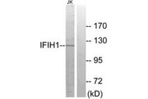 Western Blotting (WB) image for anti-Interferon Induced with Helicase C Domain 1 (IFIH1) (AA 976-1025) antibody (ABIN2889746) (IFIH1 Antikörper  (AA 976-1025))