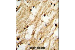 Formalin-fixed and paraffin-embedded human brain tissue with DCC1 Antibody (N-term), which was peroxidase-conjugated to the secondary antibody, followed by DAB staining. (DSCC1 Antikörper  (N-Term))