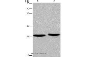 Western blot analysis of Mouse brain and human fetal muscle tissue, using EPDR1 Polyclonal Antibody at dilution of 1:850 (EPDR1 Antikörper)