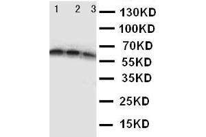 Anti-CD40 antibody, Western blotting Lane 1: Recombinant Human CD40 Protein 10ng Lane 2: Recombinant Human CD40 Protein 5ng Lane 3: Recombinant Human CD40 Protein 2. (CD40 Antikörper  (N-Term))