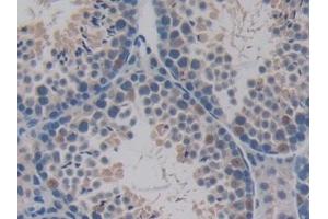 Detection of PDHX in Mouse Testis Tissue using Polyclonal Antibody to Pyruvate Dehydrogenase Complex Component X (PDHX)