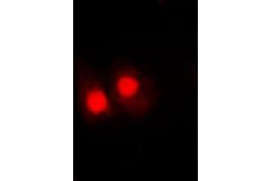 Immunofluorescent analysis of FANCA (pS1149) staining in HepG2 cells.