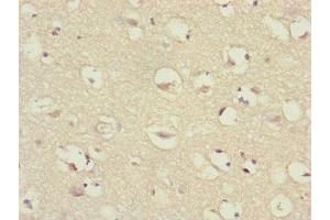 Immunohistochemistry of paraffin-embedded human brain tissue using ABIN7147409 at dilution of 1:100 (CEP57 Antikörper  (AA 1-240))