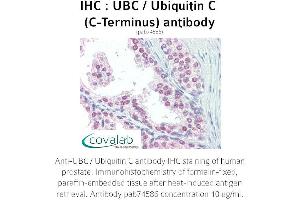 Image no. 1 for anti-Ubiquitin C (UBC) (C-Term) antibody (ABIN2852400) (UBC Antikörper  (C-Term))