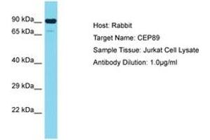 Image no. 1 for anti-Centrosomal Protein 89kDa (CEP89) (AA 41-90) antibody (ABIN6750706) (CEP89 Antikörper  (AA 41-90))