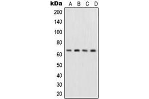Western blot analysis of NF-kappaB p65 expression in HepG2 (A), MCF7 (B), Raw264.
