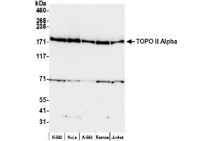 anti-Topo IIalpha (C-Term) antibody
