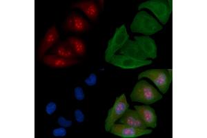 ABIN6258502 and ABIN6274615 staining Hela cells by IF/ICC.