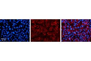 Immunohistochemistry (IHC) image for anti-Solute Carrier Family 25 (Mitochondrial Carrier, Oxoglutarate Carrier), Member 11 (SLC25A11) (C-Term) antibody (ABIN502439) (SLC25A11 Antikörper  (C-Term))
