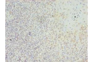 Immunohistochemistry (IHC) image for anti-Leukocyte Immunoglobulin-Like Receptor, Subfamily A (With TM Domain), Member 2 (LILRA2) (AA 9-275) antibody (ABIN7158252)