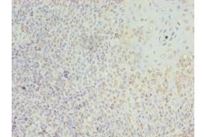 Immunohistochemistry of paraffin-embedded human tonsil tissue using ABIN7158252 at dilution of 1:100