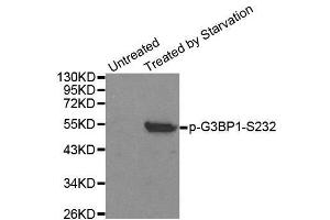 Western blot analysis of extracts from 293 cells, using Phospho-G3BP1-S232 antibody. (G3BP1 Antikörper  (pSer232))
