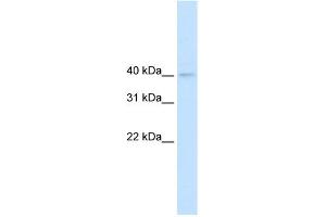 Western Blotting (WB) image for anti-Nudix (Nucleoside Diphosphate Linked Moiety X)-Type Motif 9 (NUDT9) (N-Term) antibody (ABIN2776345)