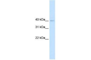 WB Suggested Anti-NUDT9 Antibody Titration:  0. (NUDT9 Antikörper  (N-Term))