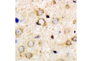 Immunohistochemical analysis of ANR52 staining in mouse brain formalin fixed paraffin embedded tissue section. (ANKRD52 Antikörper)