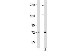 Western blot testing of human 1) placenta and 2) Jurkat lysate with TAP2 antibody at 1:2000. (TAP2 Antikörper  (AA 100-134))