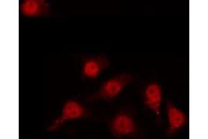 Immunofluorescence (fixed cells) (IF/ICC) image for anti-Jun D Proto-Oncogene (JUND) (pSer255) antibody (ABIN6255135)