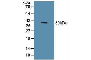 Figure. (FCGR3A Antikörper  (AA 26-108))