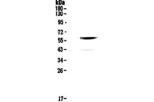 Western blot analysis of Cannabinoid Receptor I using anti-Cannabinoid Receptor I antibody .