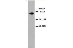 Western blot analysis of Hela cell lysis with PKCalpha antibody (PKC alpha Antikörper  (C-Term))