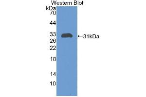 Western blot analysis of the recombinant protein. (CHI3L1 Antikörper  (AA 117-364))