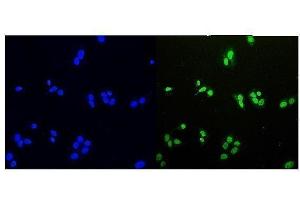 IF analysis of HDGF using anti-HDGF antibody (ABIN4886613). (HDGF Antikörper  (C-Term))